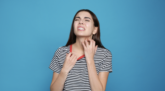 Kid’s Eczema – 5 Tips To Manage Your Child’s Eczema – Naturally