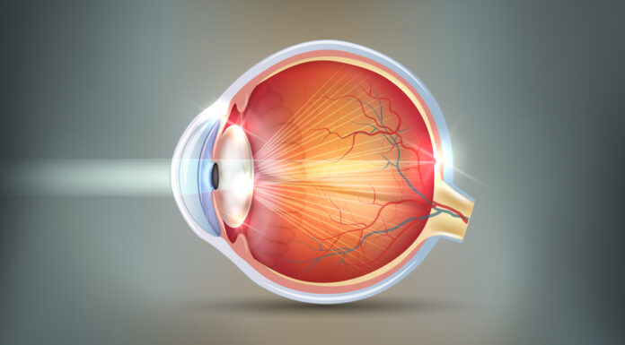 THE EYE CONDITION OF HAVING CATARACTS Cataracts abstract grey background